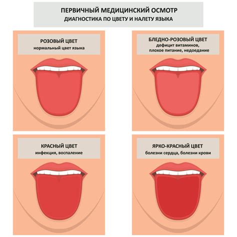 Заболевания, при которых возможно заглатывание языка