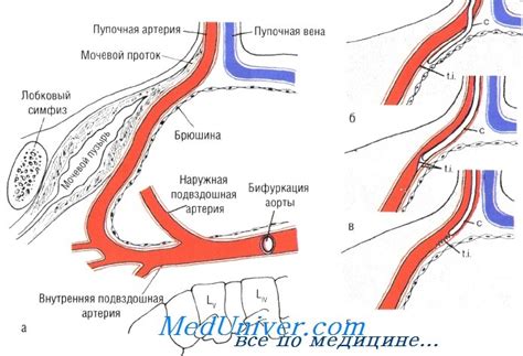 Завяжите пупочную артерию специальной силиконовой или шелковой нитью