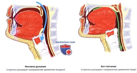 Затруднение глотания