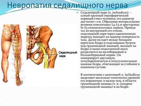 Защемление седалищного нерва: причины и способы предотвращения