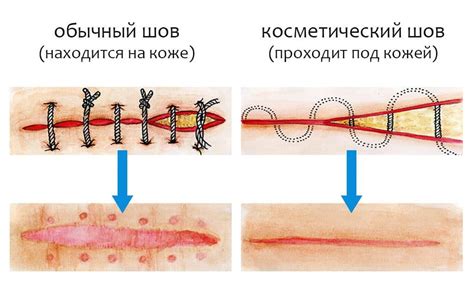 Значение и интерпретация образа швов на теле во время сна