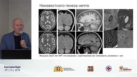 Значение прозрачности для пациента и врача