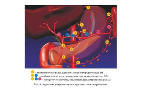 Значение рака желудка в сновидении и рекомендации