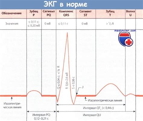 Значения нормальных параметров QRS