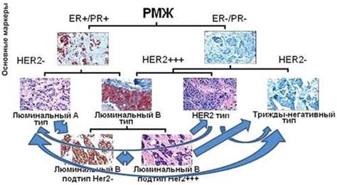 Значимость негативного статуса опухоли Her2-отрицательного 0