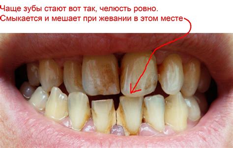 Значимость снов: выкатывающиеся зубы с кровавым следом