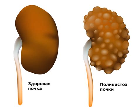 Из-за чего может появиться красноватая моча?