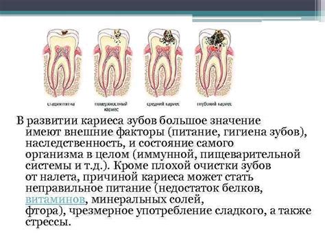 Интерпретация и значение зубного кариеса в сновидениях