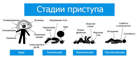 Интерпретация символов и значений эпилептического приступа у молодого мужчины во сне