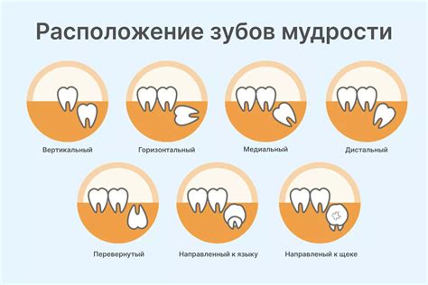 Интерпретация снов об трещине зуба мудрости: разгадка скрытого сообщения