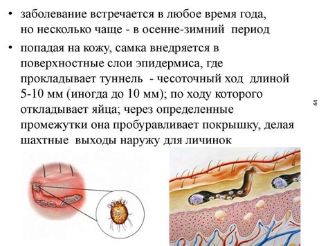 Инфекционные и паразитарные болезни