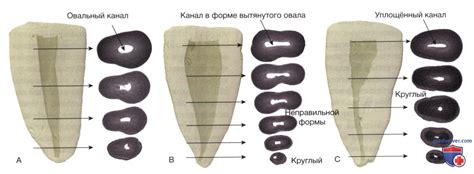 Исключительное значение сновидения об утрате корневого зуба и отсутствии следов крови