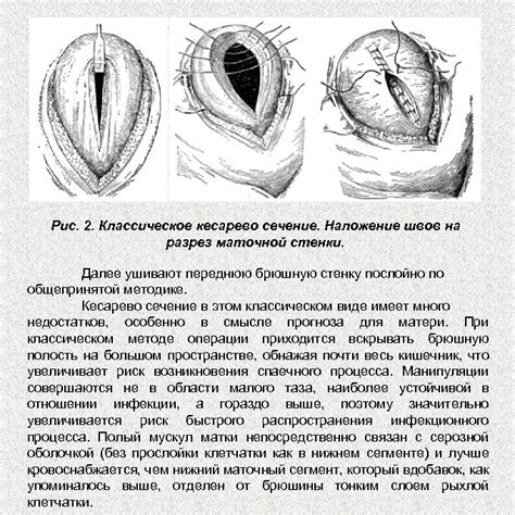 Исторический контекст снов о операции кесарева