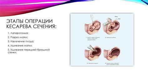 Историческое значение операции кесарева сновидения