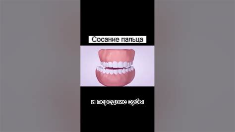 Какие последствия может иметь такая привычка?