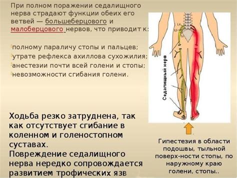 Какие симптомы указывают на защемление нерва?