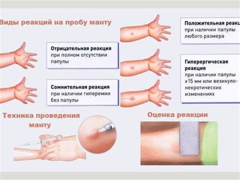 Какое время нужно для проверки диаскинтеста у ребенка?