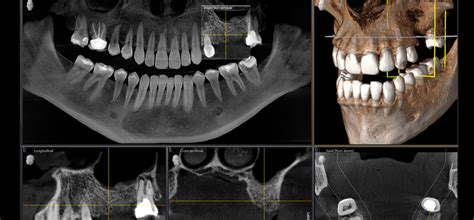 Какой метод диагностики лучше: КТ или 3D-снимок челюсти?