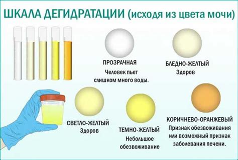 Какой нормальный объем мочи у взрослых мужчин?