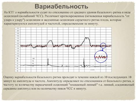 Как измерить уровень вариабельности на КТГ?