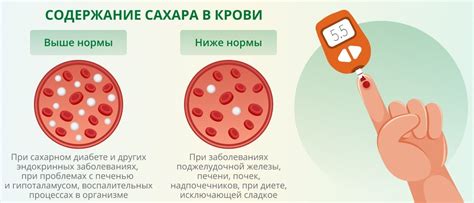 Как измеряется уровень сахара в крови человека?