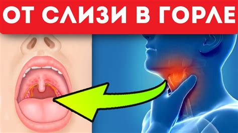 Как можно улучшить свою ситуацию, если у вас отросток в горле за языком?