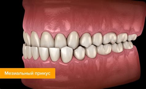 Как называется челюсть, которая вытянута вперед?