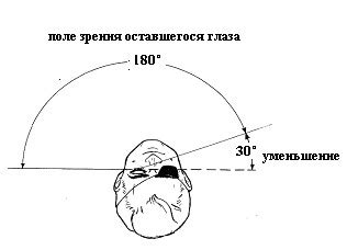 Как определить ослабленное зрение одного глаза?