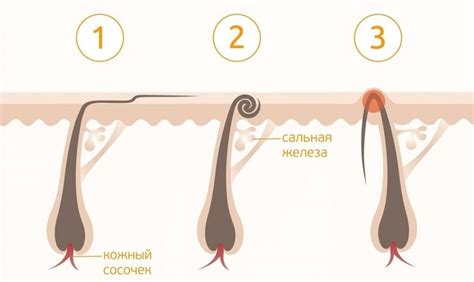 Как определить присутствие вросших волос на лице?