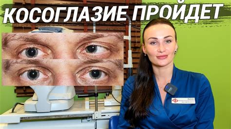 Как помочь ребенку с косоглазием?