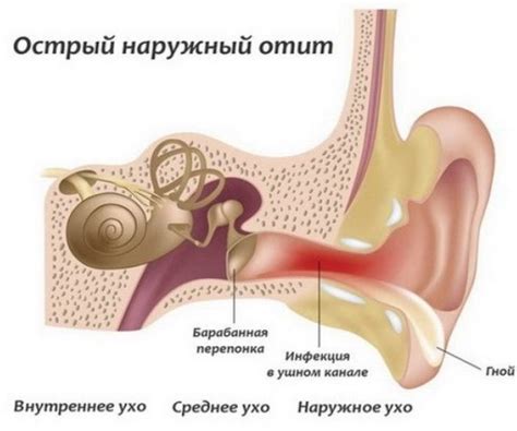 Как предотвратить воспаление уха от сережки