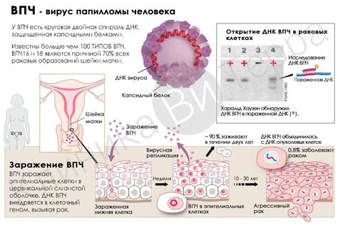 Как проводится диагностика папилломавируса человека у женщин?