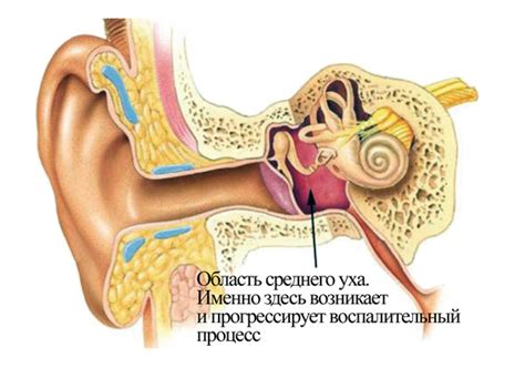 Как происходит лечение шишек внутри уха?