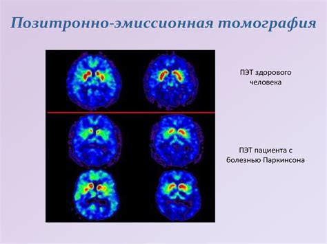 Как разгадывать сновидения о болезни головного мозга у мужчины