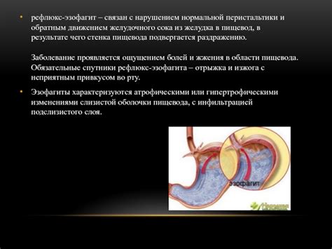 Как рефлюксный эзофагит может быть связан с наблюдением кровянистого плевка во время сна