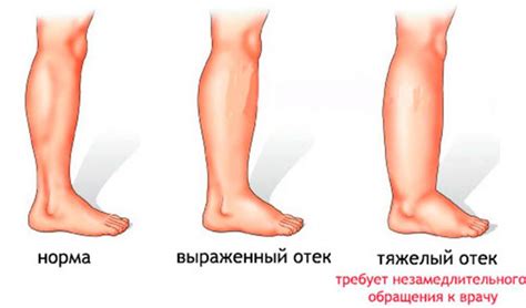 Как связана некоторая кожная реакция с чесанием ног?