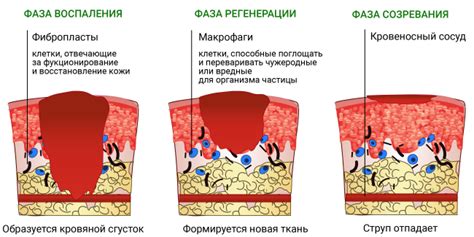 Как ускорить заживление пузыря от ожога