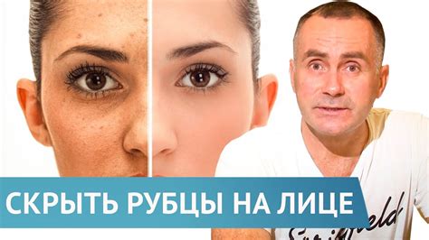 Как устранить рубец на коже лица?