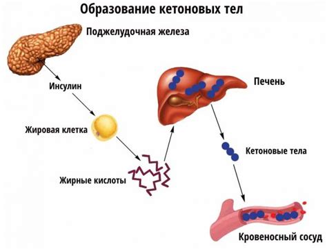 Кетоны в крови: сущность и значение