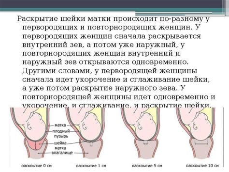 Когда начинается раскрытие на 1 палец во время родов? 