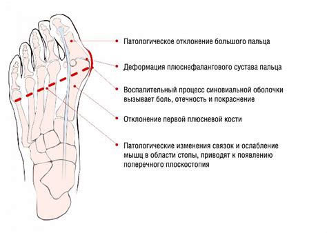 Когда обратиться к врачу в случае трещины на пальце ноги