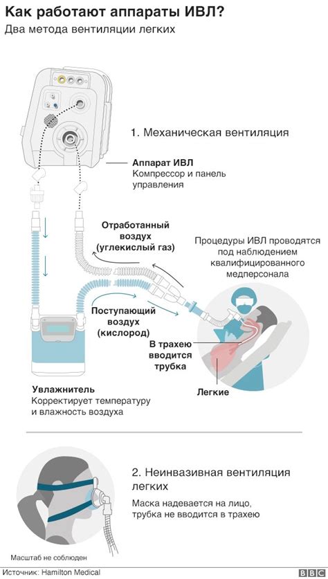 Когда применяют кислородную маску и аппарат ИВЛ