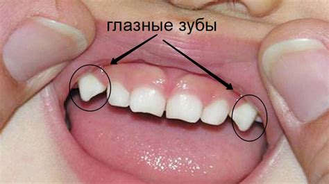 Когда растут клыки у ребенка: возрастные особенности