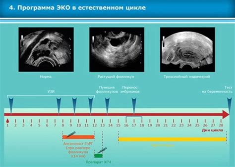 Короткий или длинный протокол эко: что выбрать? Вопросы и ответы