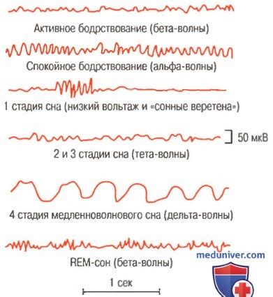 Крайнее проявление неконтролируемой слизистой активности во время состояния сна у представительниц прекрасного пола
