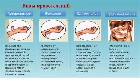 Кровотечение и его последствия