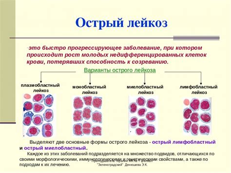 Лейкоз: типы, стадии и основные методы борьбы