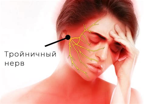 Лечение воспаления тройничного нерва на лице: методы и рекомендации