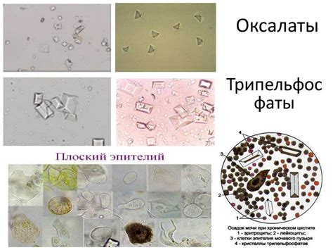 Лечение трипельфосфатов в моче кошки