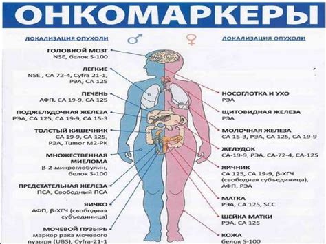 Локализация опухоли